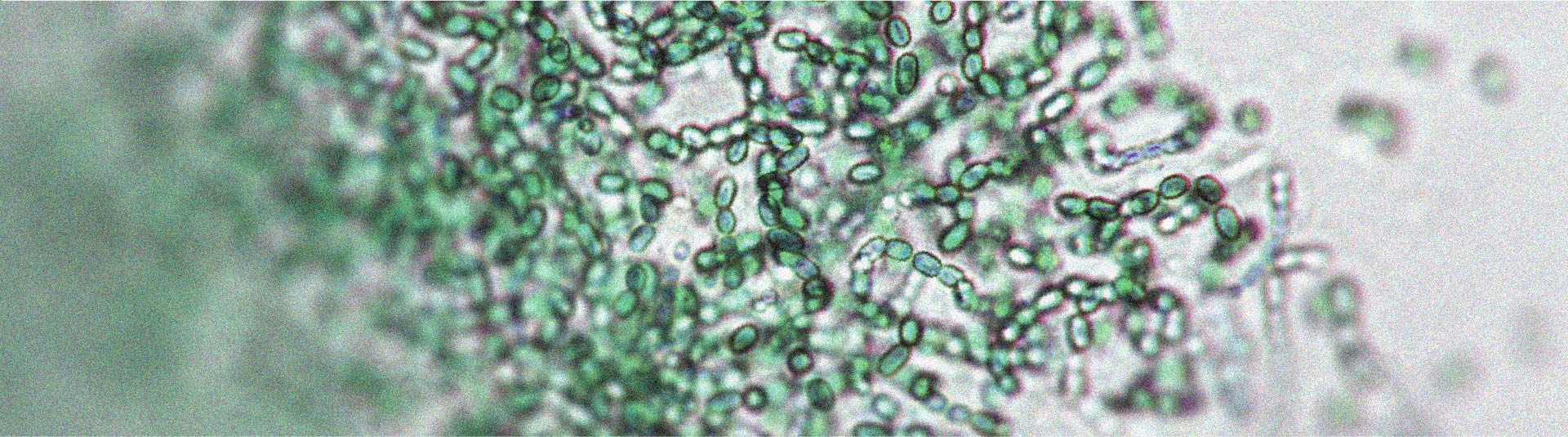 Il existe une relation entre le microbiote intestinal et l’activité physique