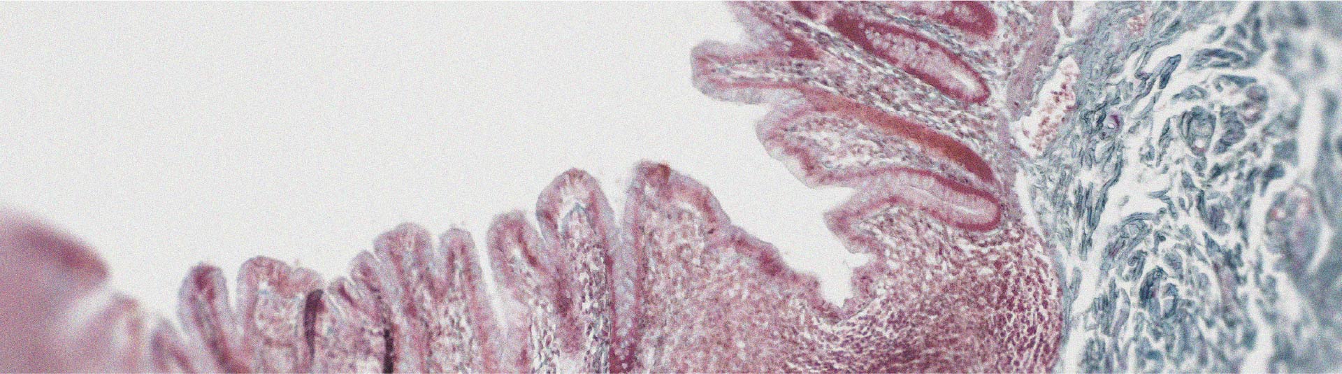 Le lien entre la glutamine et la permeabilite intestinale