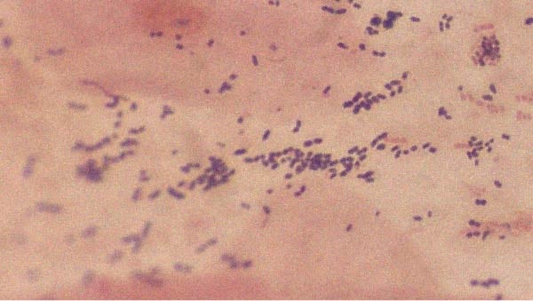 Tout ce qu’il faut savoir sur le Lactobacillus acidophilus