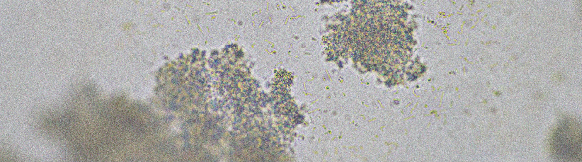 Souches probiotiques susceptibles d’aider à soulager la diarrhée
