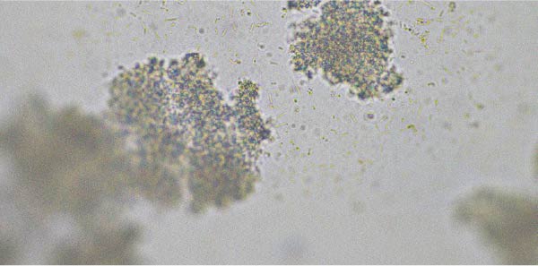 Souches probiotiques susceptibles d’aider à soulager la diarrhée