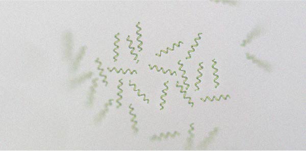 La spiruline pourrait aider à perdre du poids