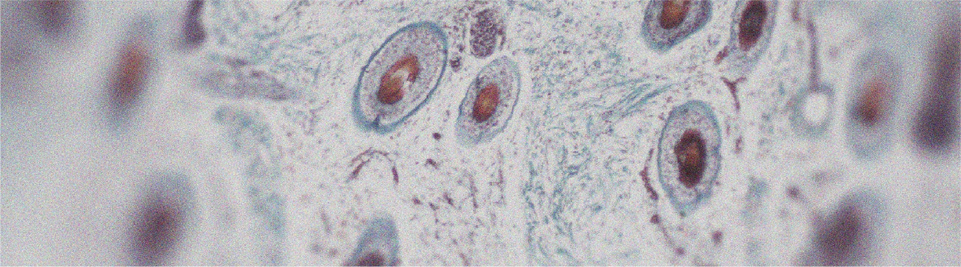 De quelles façons la vitamine A peut-elle être bénéfique pour la peau ?