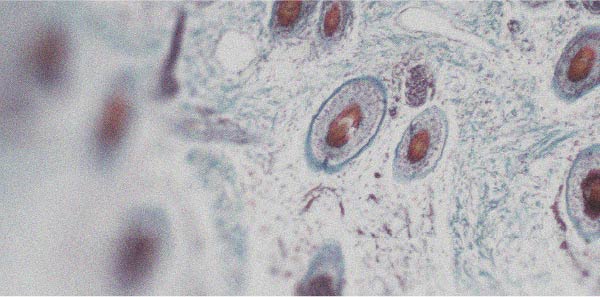 De quelles façons la vitamine A peut-elle être bénéfique pour la peau ?